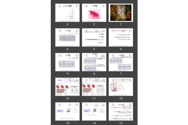 پاورپوینت تفسیر ECG