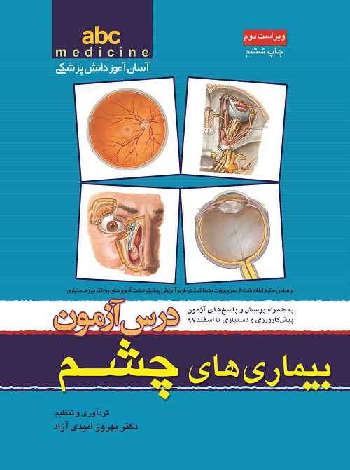 abc چشم درس آزمون بیماری های چشم