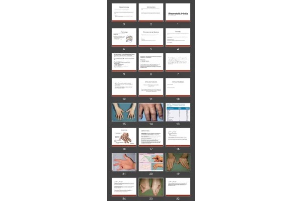 پاورپوینت Rheumatoid Arthritis