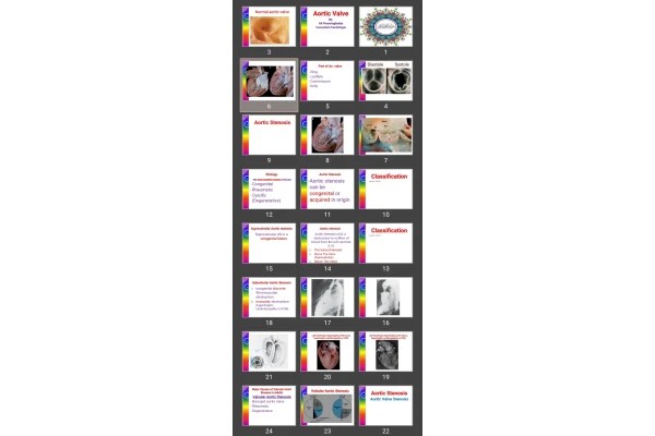 پاورپوینت Aortic Valve