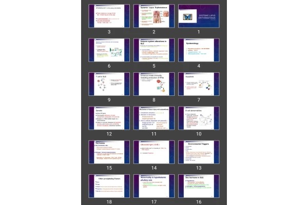 پاورپوینت Systemic lupus erythematosus