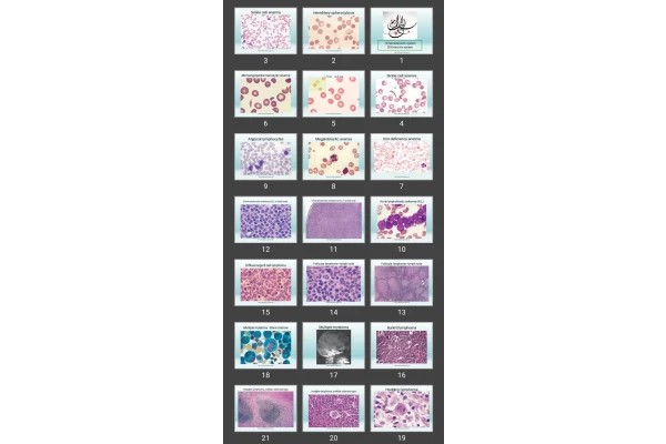 پاورپوینت hematopoietic &amp; Endocrine