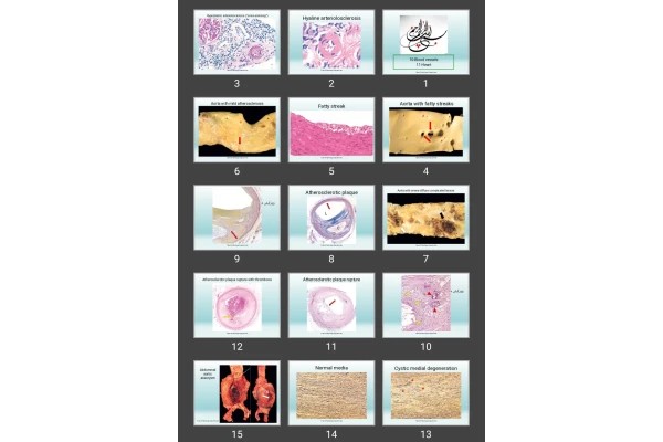 پاورپوینت Blood vessels