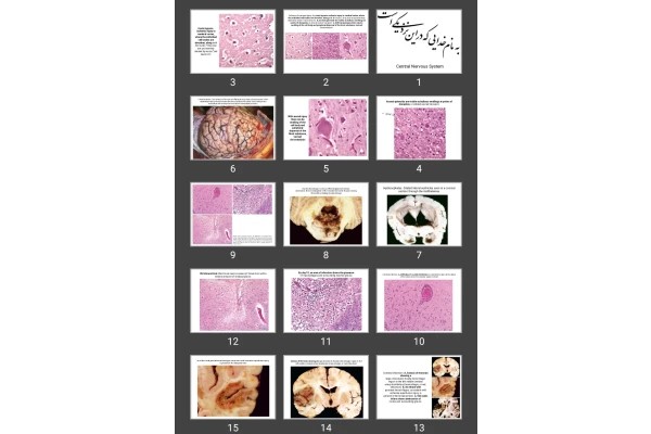 پاورپوینت Central Nervous System