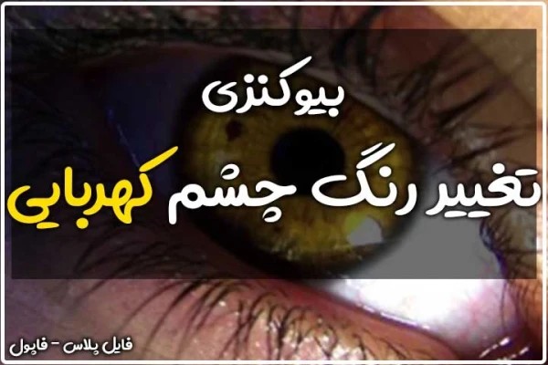 بیوکنزی چشم کهربایی یا طلایی