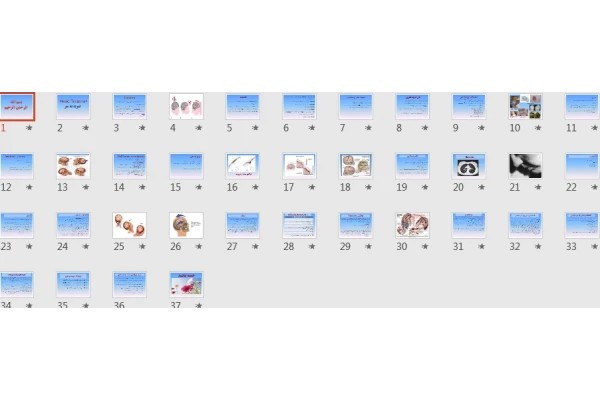 پاورپوینت ضربه به سر