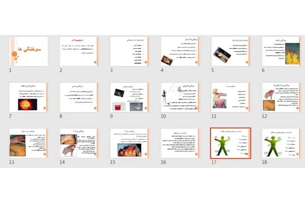 پاورپوینت سوختگي ها