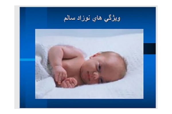 پاورپوینت ویژگی های نوزاد سالم