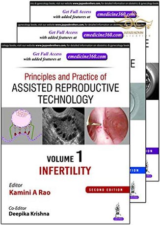 Principles and Practice of Assisted Reproductive Technology : Three Volume Set 2018