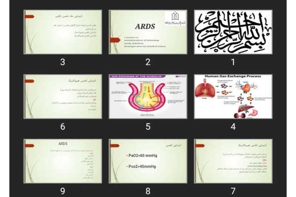 پاورپوینت ARDS