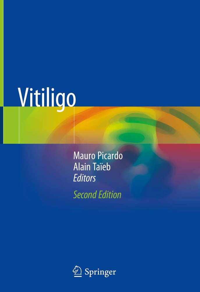 برص ۲۰۱۹ <br> Vitiligo 2019 - کالیبو