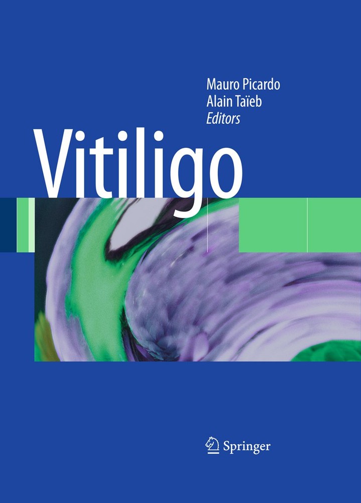 برص ۲۰۰۹ <br> Vitiligo 2009 - کالیبو