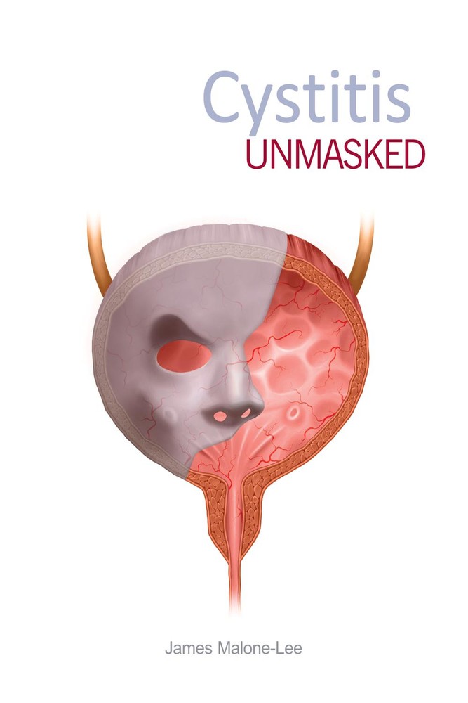 سیستیت: پرده برداری از یک بیماری ۲۰۲۱ <br> Cystitis unmasked 2021 - کالیبو