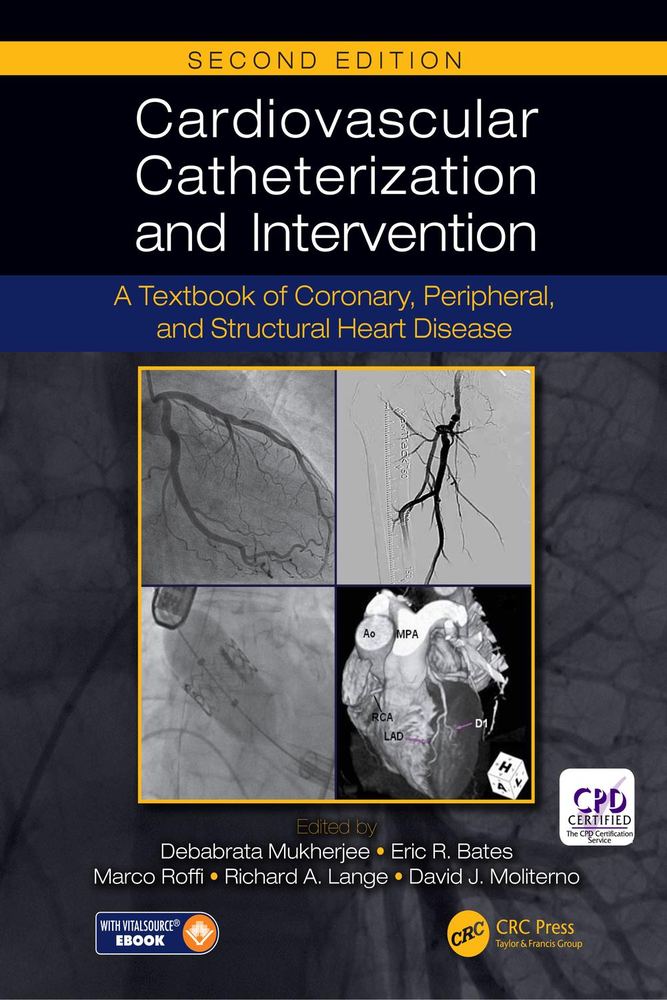 کاتتریزاسیون و مداخله قلبی‌عروقی ۲۰۱۷ <br> Cardiovascular Catheterization and Intervention 2017 - کالیبو