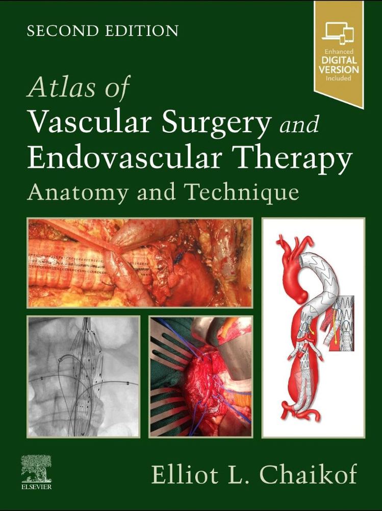 Atlas of Vascular Surgery and Endovascular Therapy: Anatomy and Technique + DVD 2026