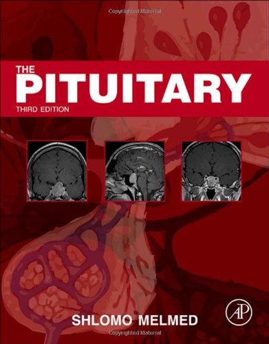 هیپوفیز ۲۰۱۰ <br> The Pituitary 2010 - کالیبو