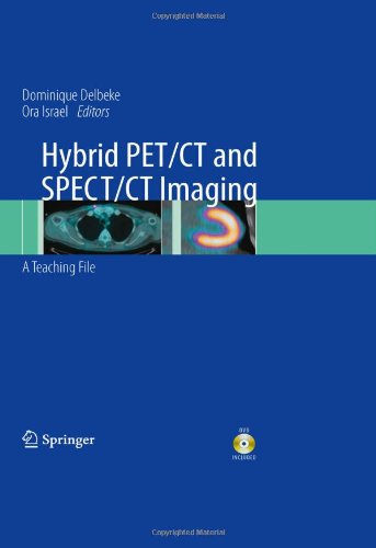 تصویربرداری ترکیبی PET/CT و SPECT/CT: مجموعه آموزشی ۲۰۰۹ <br> Hybrid PET/CT and SPECT/CT Imaging: A Teaching File 2009 - کالیبو