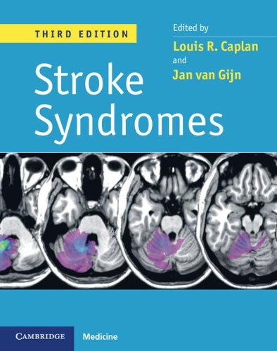 نشانگان های سکته مغزی، ویرایش سوم ۲۰۱۲ <br> Stroke Syndromes, 3ed 2012 - کالیبو