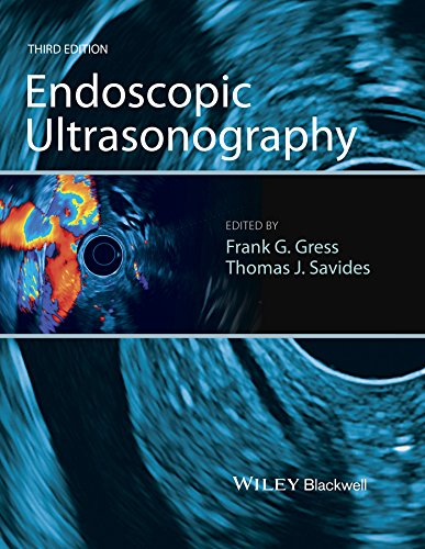سونوگرافی آندوسکوپی ۲۰۱۶ <br> Endoscopic Ultrasonography 2016 - کالیبو