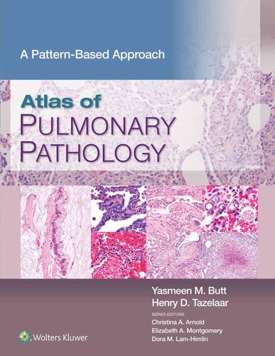اطلس آسیب شناسی ریوی: رویکردی مبتنی بر الگو ۲۰۲۱ <br> Atlas of Pulmonary Pathology: A Pattern Based Approach 2021 - کالیبو