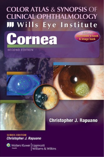 قرنیه ۲۰۱۱ <br> Cornea 2011 - کالیبو