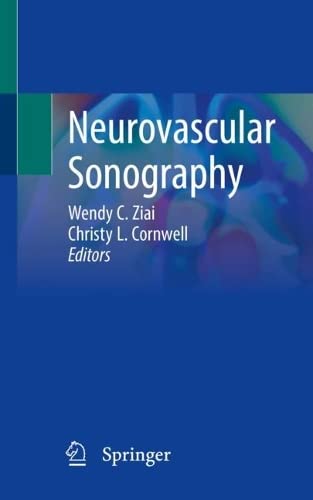 سونوگرافی نوروواسکولار ۲۰۲۲ <br> Neurovascular Sonography 2022 - کالیبو