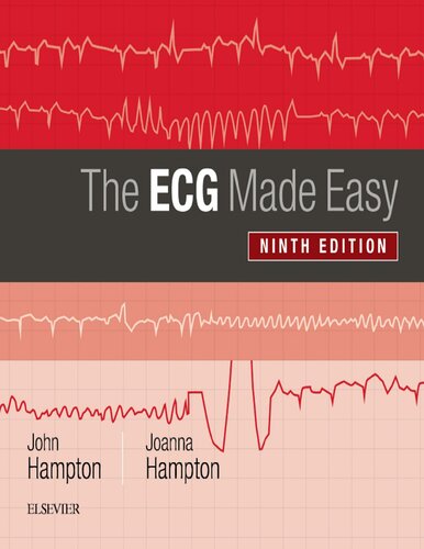 ECG آسان شد (۲۰۱۹) <br> The ECG Made Easy 2019 - کالیبو