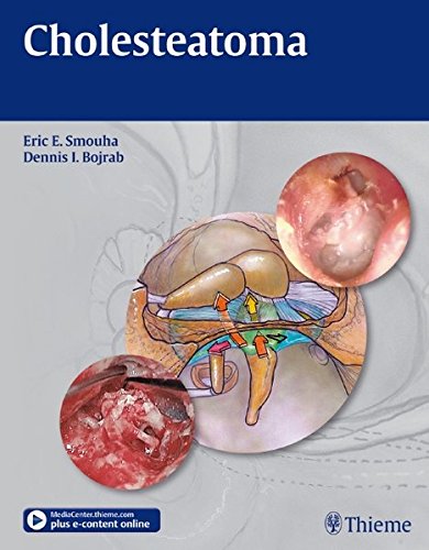 کلستتاتوم ۲۰۱۰ <br> Cholesteatoma 2010 - کالیبو
