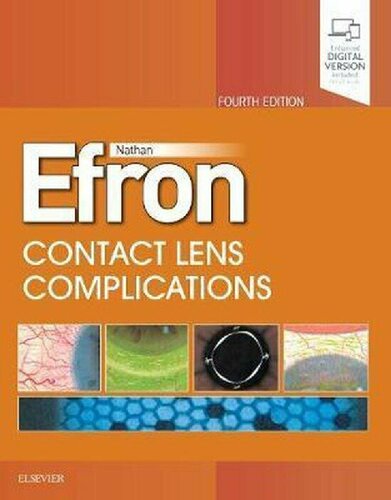 با عوارض لنز تماس بگیرید ۲۰۱۹ <br> Contact Lens Complications 2019 - کالیبو