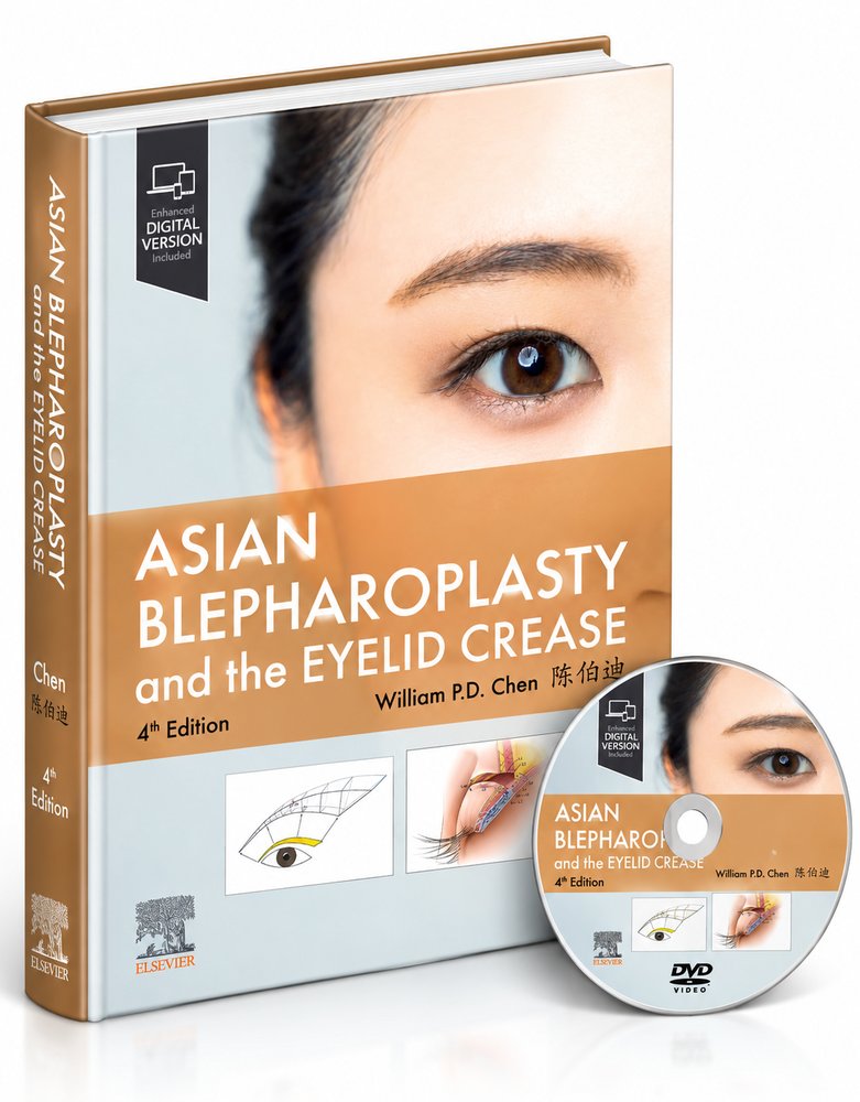Asian Blepharoplasty and the Eyelid Crease – 4th Edition