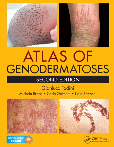 دانلود کتاب Atlas of Genodermatoses, 2nd Edition