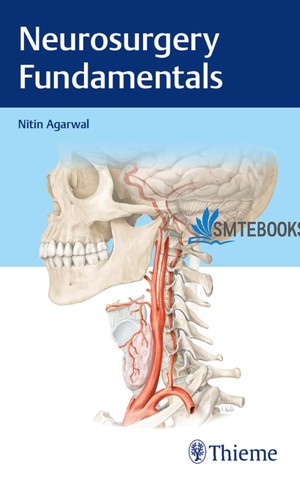 دانلود کتاب Neurosurgery Fundamentals-Thieme