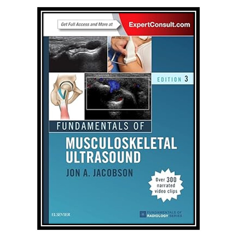 کتاب Fundamentals of Musculoskeletal Ultrasound اثر Jon A. Jacobson انتشارات مؤلفین طلایی
