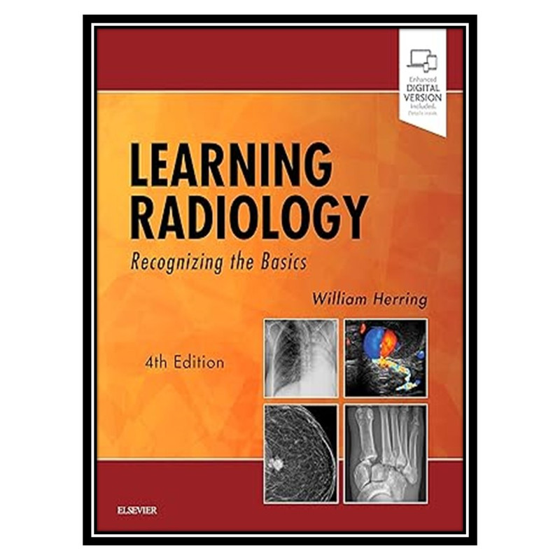 کتاب Learning Radiology: Recognizing the Basics اثر William Herring انتشارات مؤلفین طلایی