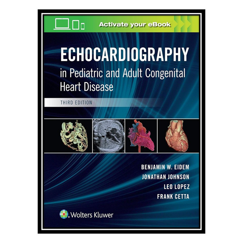 کتاب Echocardiography in Pediatric and Adult Congenital Heart Disease اثر جمعی از نویسندگان انتشارات مؤلفین طلایی