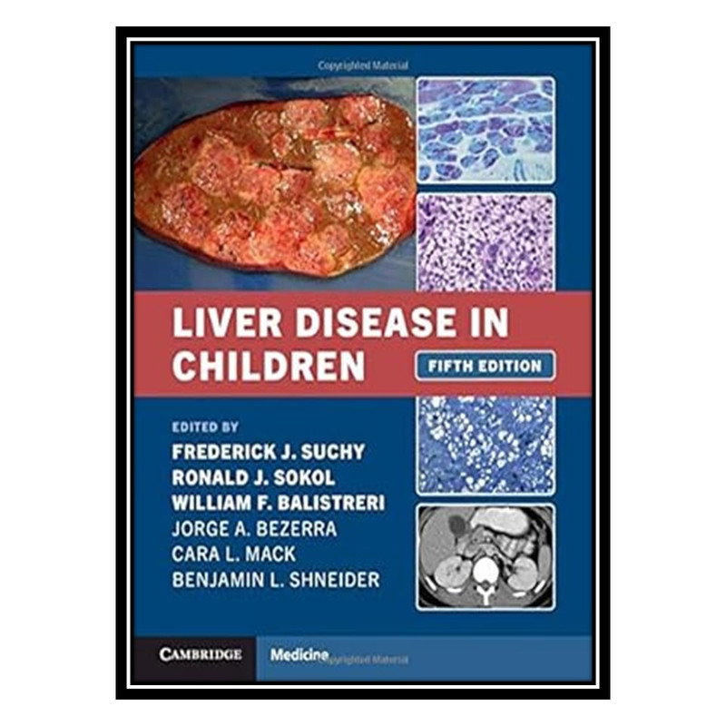 کتاب Liver Disease in Children اثر جمعی از نویسندگان انتشارات مؤلفین طلایی