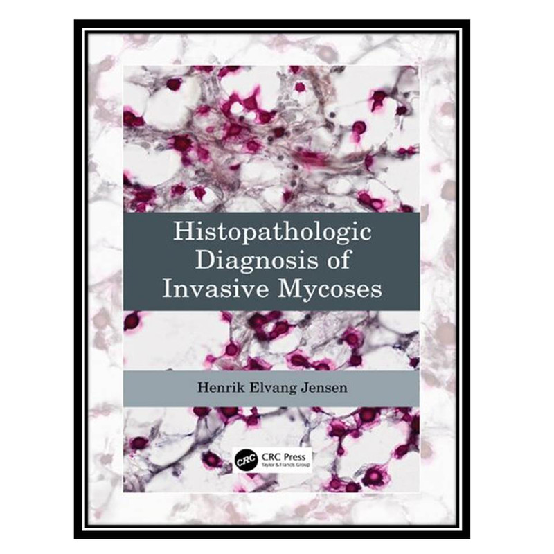 کتاب Histopathologic Diagnosis of Invasive Mycoses اثر Henrik Elvang Jensen انتشارات مؤلفین طلایی