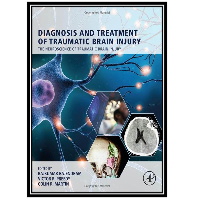 کتاب The Neuroscience of Traumatic Brain Injury, 2 Volume Set اثر جمعی ازنویسندگان انتشارات مؤلفین طلایی