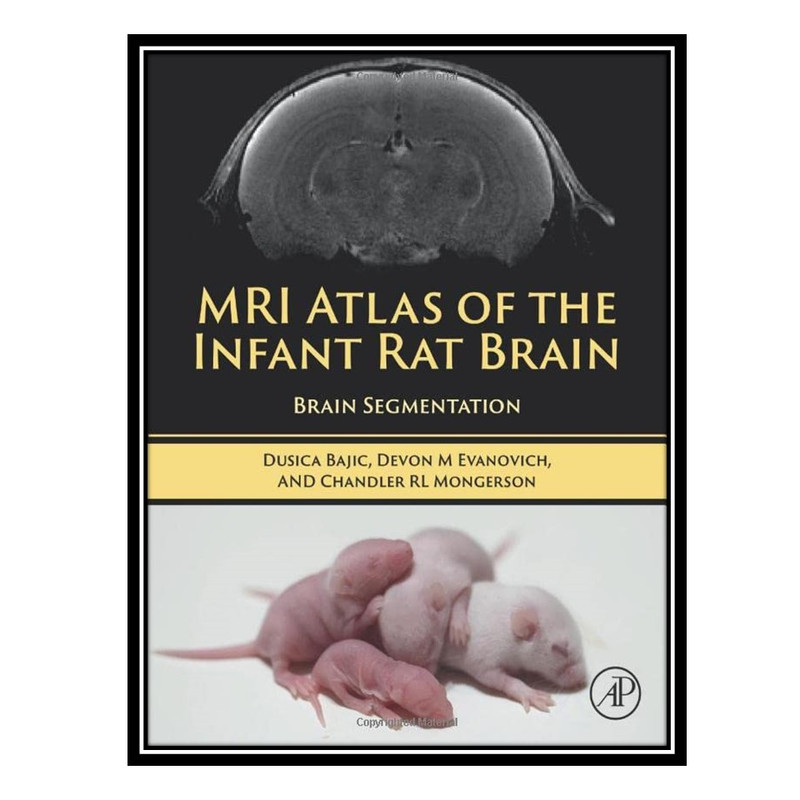 کتاب MRI Atlas of the Infant Rat Brain: Brain Segmentation اثر جمعی از نویسندگان انتشارات مؤلفین طلایی