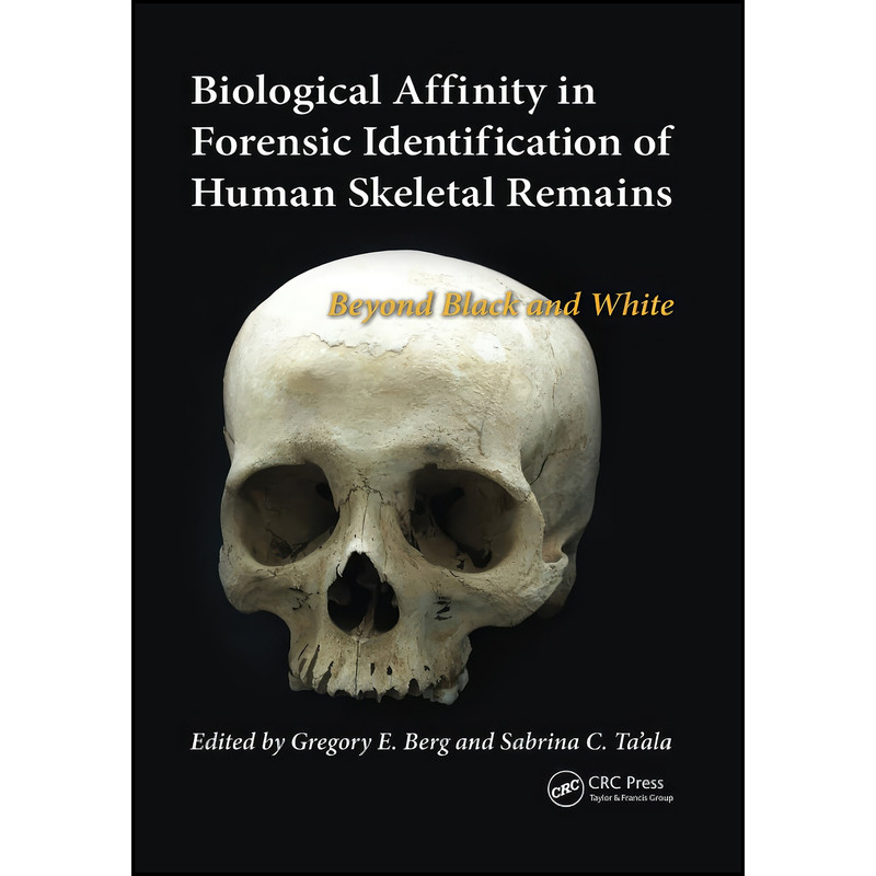 کتاب Biological Affinity in Forensic Identification of Human Skeletal Remains اثر جمعي از نويسندگان انتشارات تازه ها