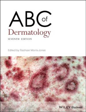 دانلود کتاب ABC of dermatology – ABC پوست