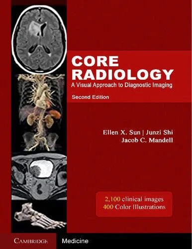 دانلود نسخه کامل کتاب انگلیسی Core radiology : A Visual Approach To Diagnostic Imaging