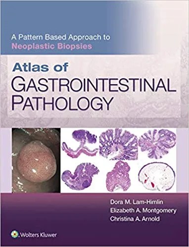 دانلود نسخه کامل کتاب Atlas of Gastrointestinal Pathology: A Pattern Based Approach to Neoplastic Biopsies