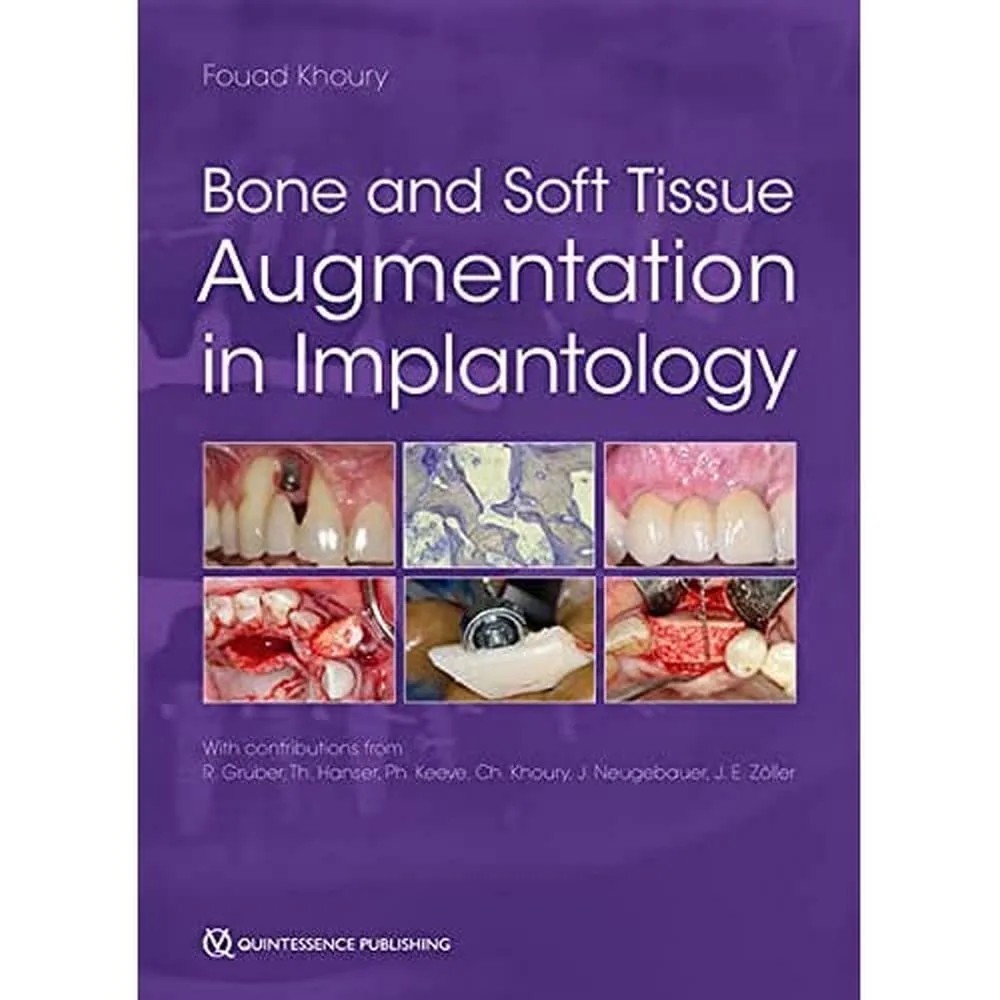 دانلود نسخه کامل کتاب Bone and Soft Tissue Augmentation in Implantology original Pdf
