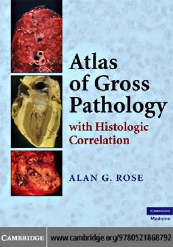 دانلود نسخه کامل کتاب Atlas of Gross Pathology: With Histologic Correlation