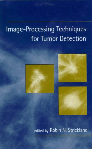 دانلود نسخه کامل کتاب Image-Processing Techniques for Tumor Detection
