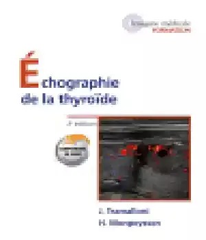 دانلود کتاب Echographie de la thyro├»de – Echographie de la thyro├»de