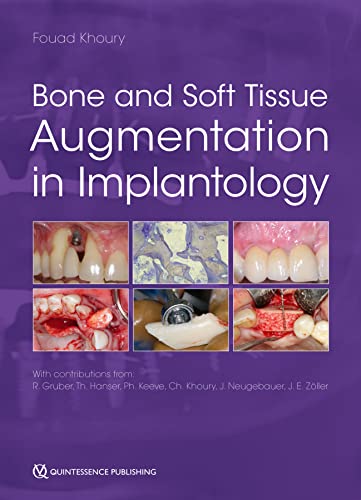 دانلود دانلود کتاب Bone and Soft Tissue Augmentation in Implantology original pdf