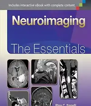 دانلود کتاب Neuroimaging: The Essentials (Essentials Series) – Neuroimaging: The Essentials (سری Essentials)