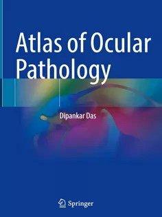 دانلود کتاب Atlas of Ocular Pathology